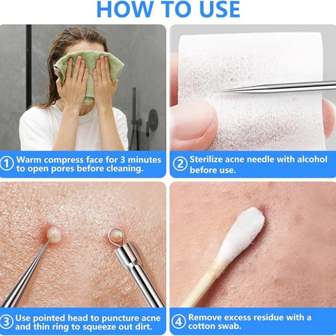 ชุดอุปกรณ์กำจัดสิวเสี้ยนและสิว - Luxury Skincare Acne บทวิจารณ์และราคา