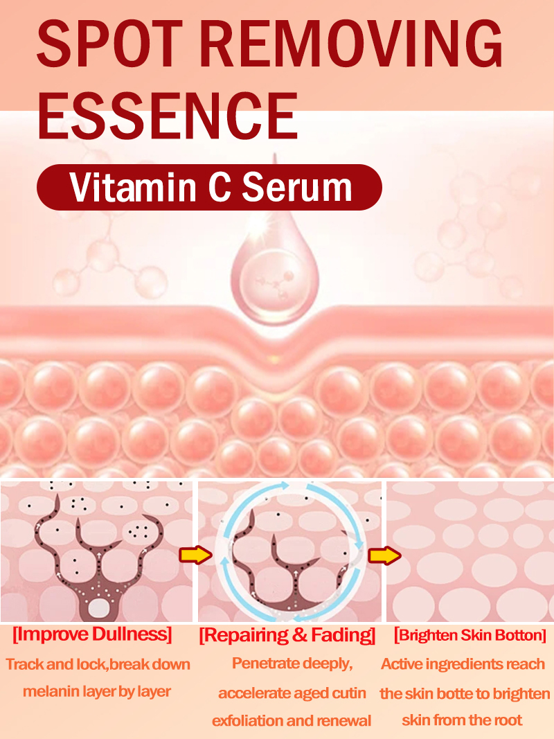 ลดเลือนฝ้า กระ จุดด่างดำบนใบหน - Luxury Skincare Essence บทวิจารณ์และราคา